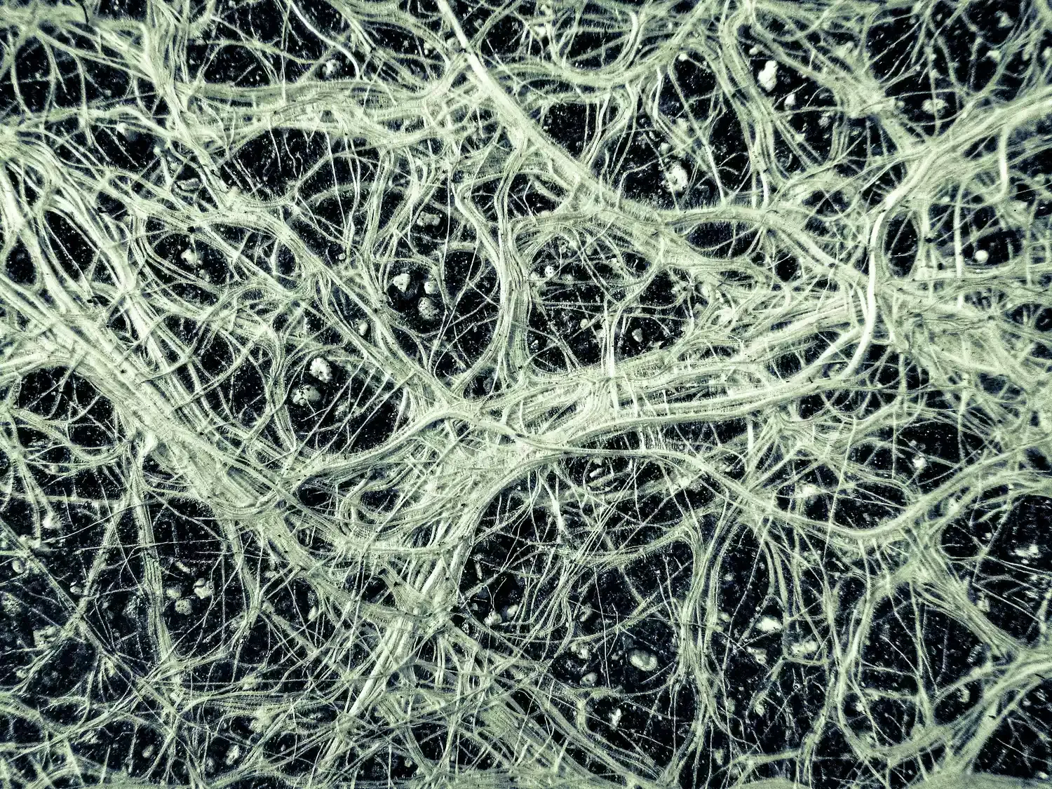 The fine roots of a vascular plant look like a neural network.oddonatta / Getty Images